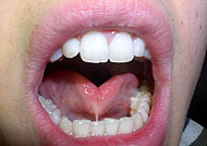 Frenulum linguae