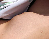 Permanent entfernte Schamhaare per Lasertechnik