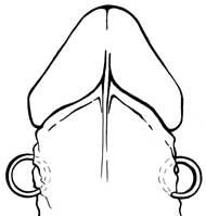 Oetang paarweise gegenüberliegend