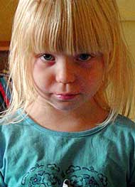 Pädophilie - Ein Fremdwort für die sexuelle Vorliebe eines Erwachsenen für Kinder.